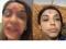 Cantora Walkiria usa redes sociais para mostrar ferida no rosto e denunciar suposta agress�o.