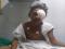 Travesti baleada no rosto passa por cirurgia de retirada do olho esquerdo em Teresina.